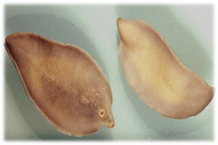 Fascioloza